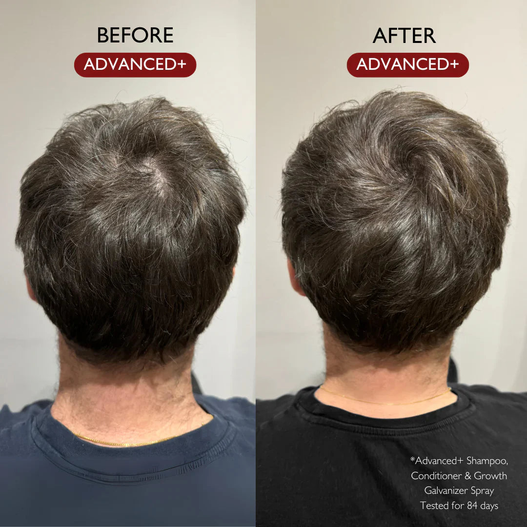 ADVANCED+ CONDITIONER